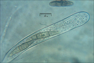 Pleosporales