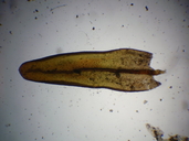 Orthotrichum euryphyllum
