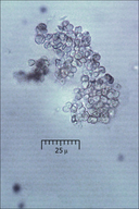 Cosmospora coccinea