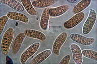 Dacryomyces chrysospermus