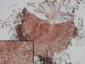 Mycocalicium albonigrum