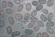 Hygrocybe acutoconica var. konradii