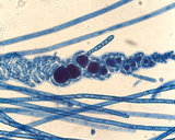 Spirocladia barodensis