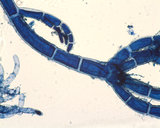 Cladophora goweri