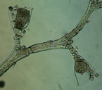Clytia gracilis