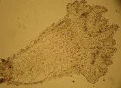 Campalecium sp. 1
