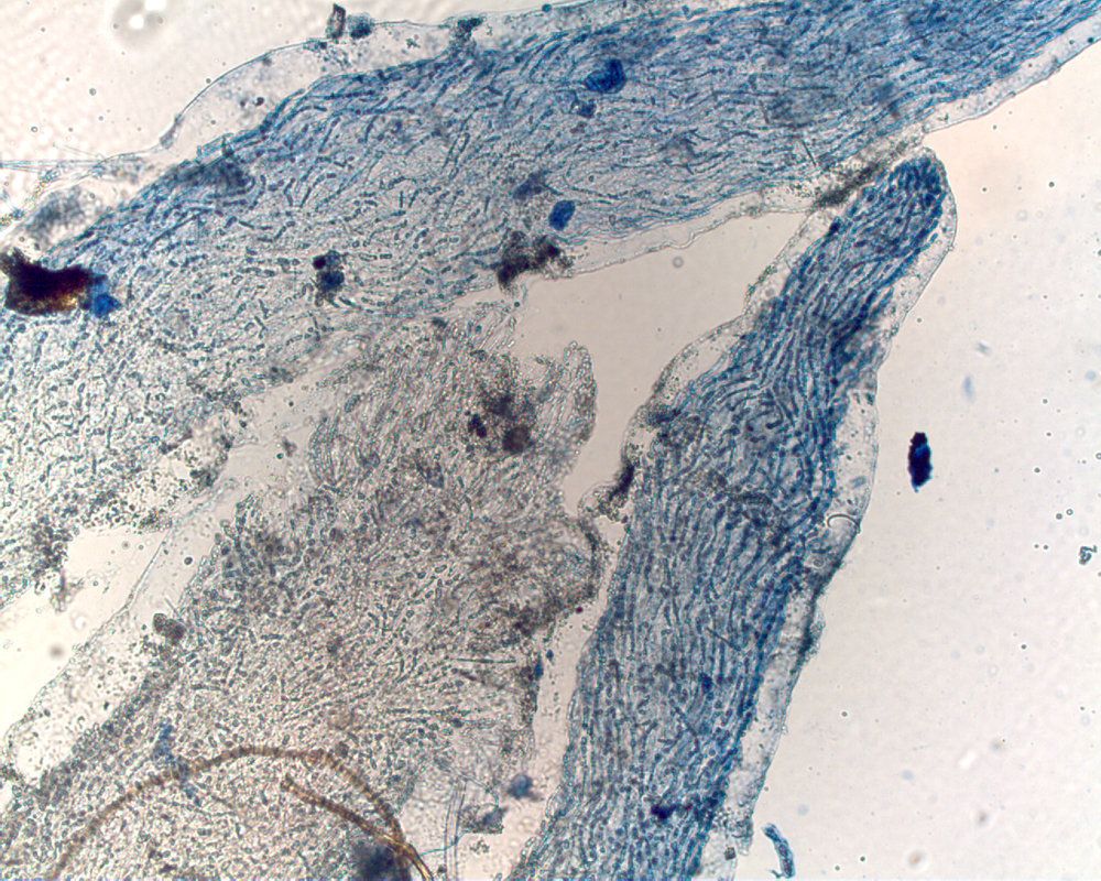 Halymenia actinophysa