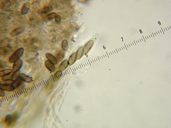 Chaenothecopsis pusilla