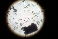 Microcalicium disseminatum