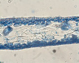 Asteromenia pseudocoalescens