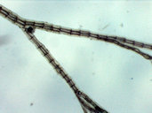 Neosiphonia sphaerocarpa