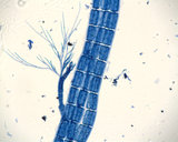 Neosiphonia apiculata