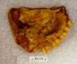 Gorgopithecus major