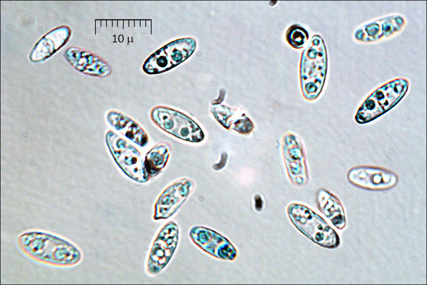 Bisporella citrina