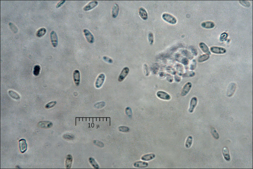 Sarcogyne regularis