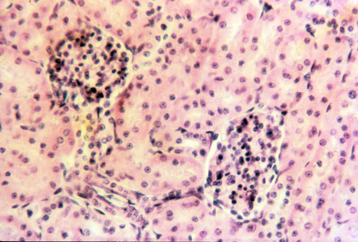 Kidney cortex with glomeruli, 100x