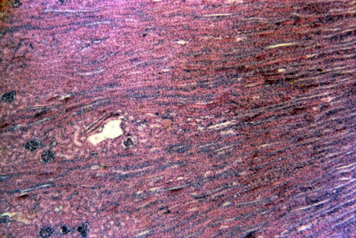 Kidney cortex and medulla, 15x Kidney cortex and medulla, 15x