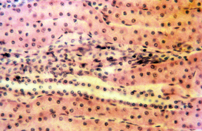 Kidney medulla, 100x Kidney medulla, 100x