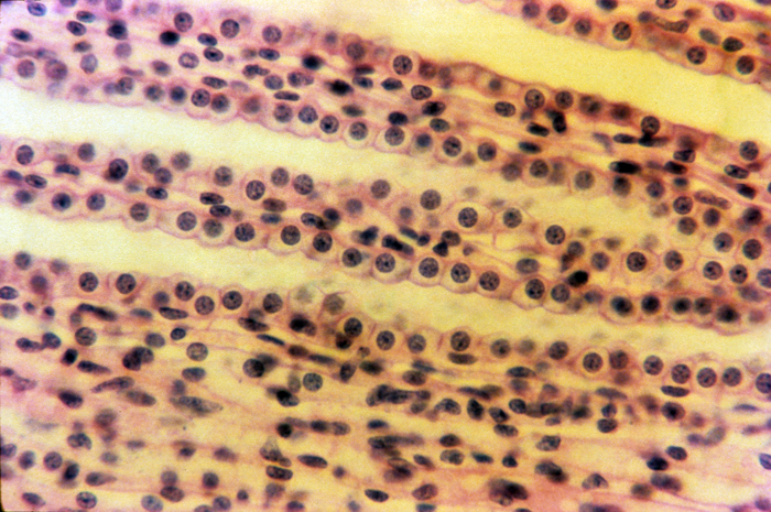 Kidney, lateral section, 120x