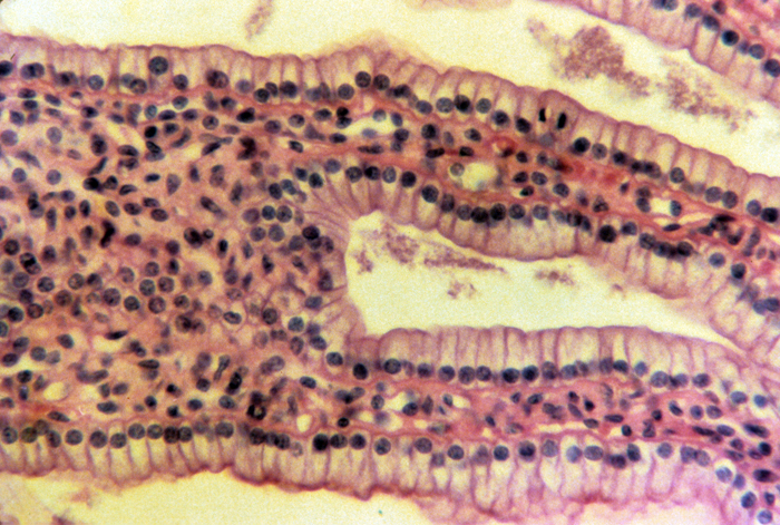 Kidney section through apical part of medulla, 100x Kidney section through apical part of medulla, 100x