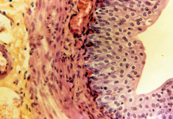 Ureter, mucosa, submucosa, and muscularis, 100x