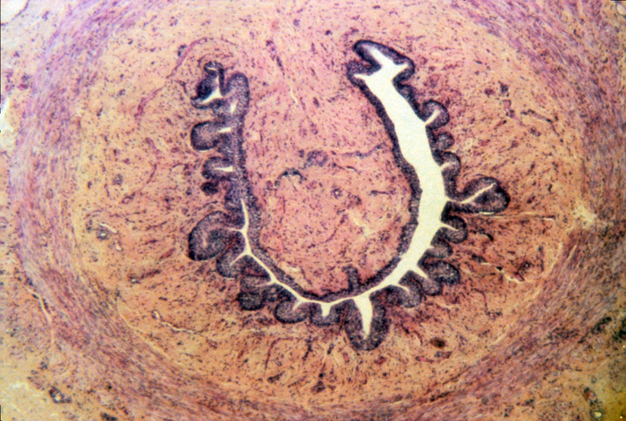 Urethra, female, irregular lumen, 50x Urethra, female, irregular lumen, 50x