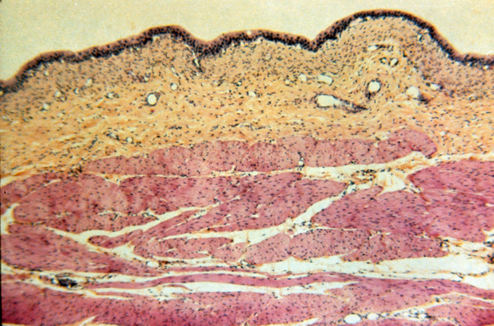 Urinary bladder cross section, 18x Urinary bladder cross section, 18x