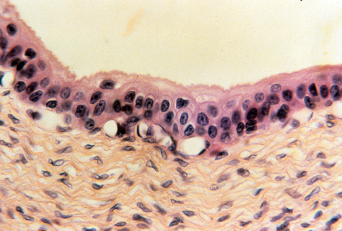 Urinary bladder mucosa and submucosa, 120x Urinary bladder mucosa and submucosa, 120x