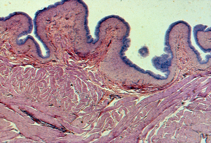 Urinary bladder, contracted, 8X Urinary bladder, contracted, 8X
