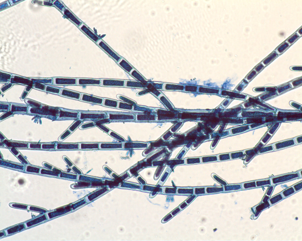 Cladophora vagabunda cf