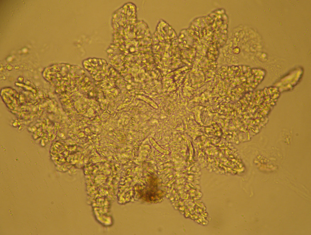 Campalecium sp. 1