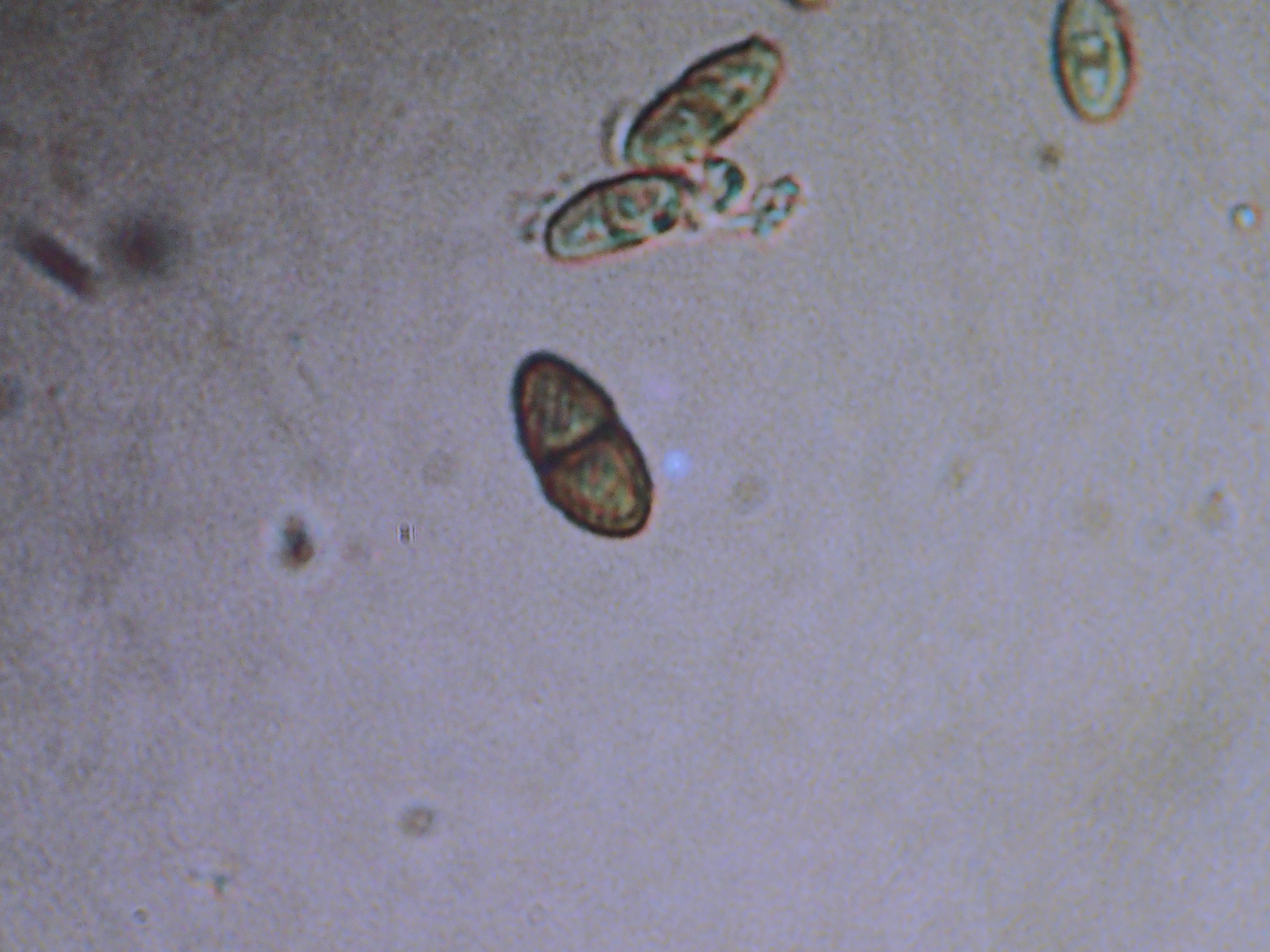 <i>Calicium adspersum</i>; Spiral-spored Gilded-head Pin Lichen