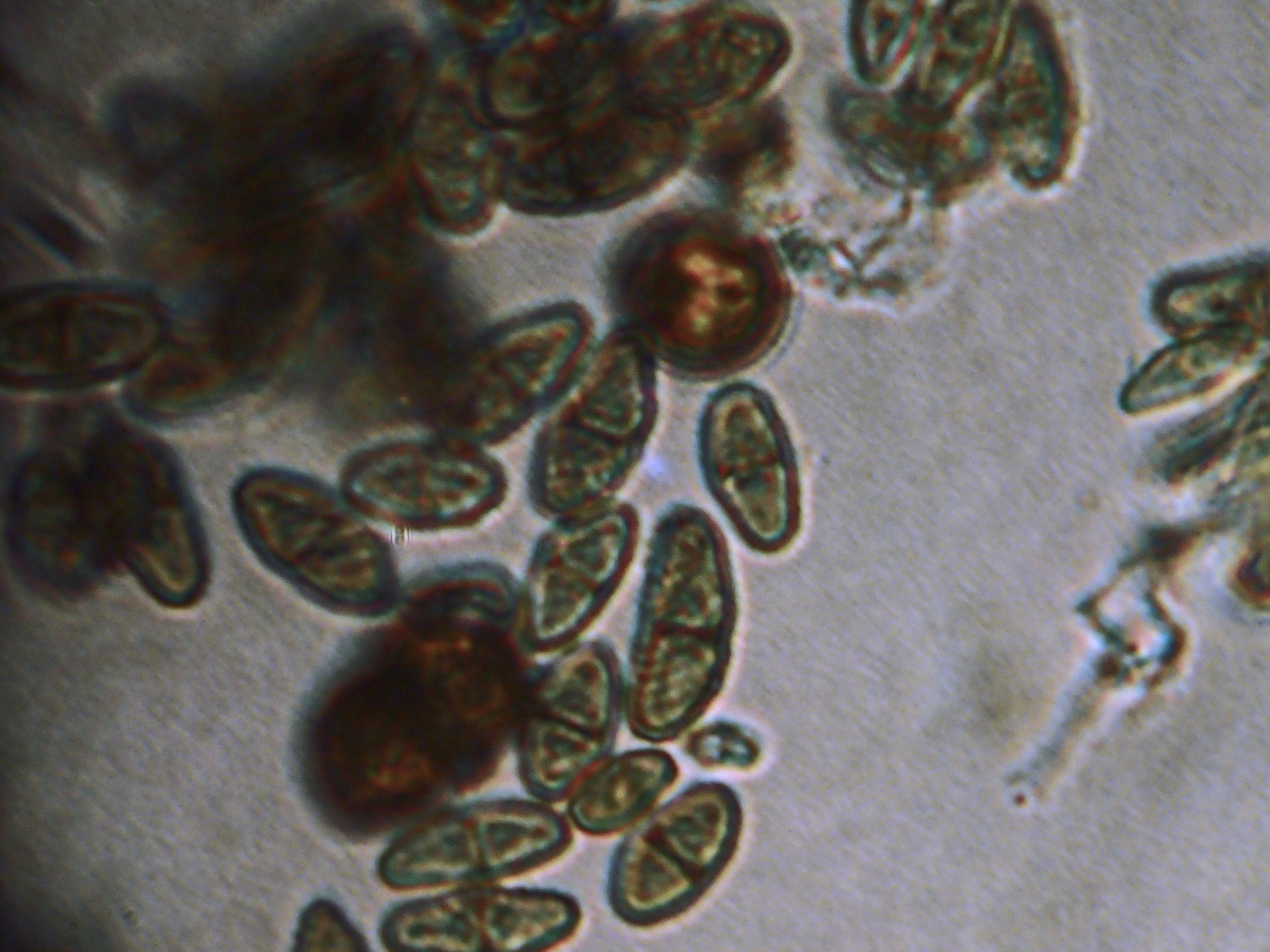 <i>Calicium adspersum</i>; Spiral-spored Gilded-head Pin Lichen